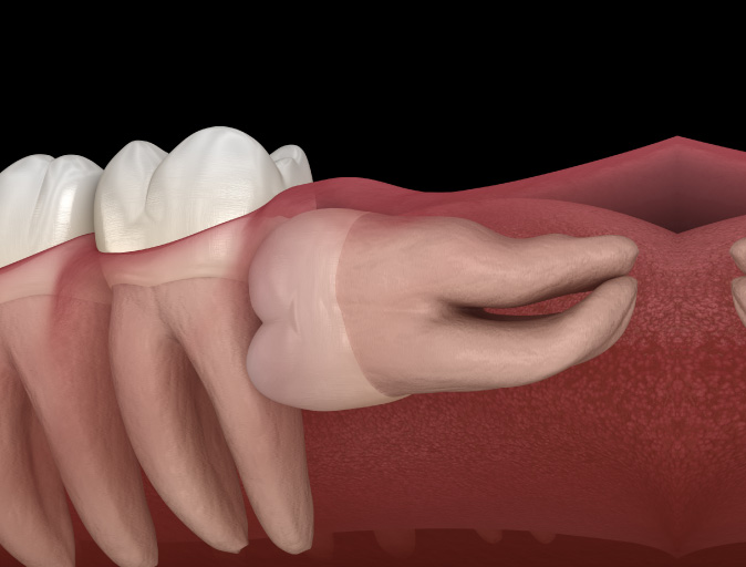 Aiken Oral Surgery