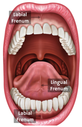 Frenectomy