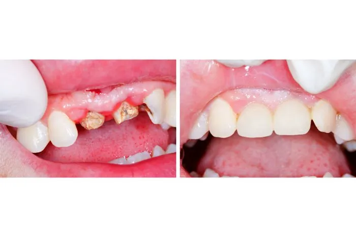 Smile Gallery at Aiken Family Dentistry in Aiken, South Carolina