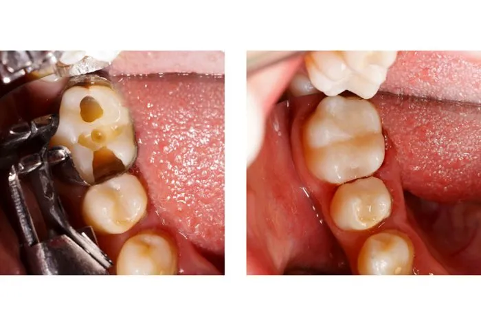 Smile Gallery at Aiken Family Dentistry in Aiken, South Carolina